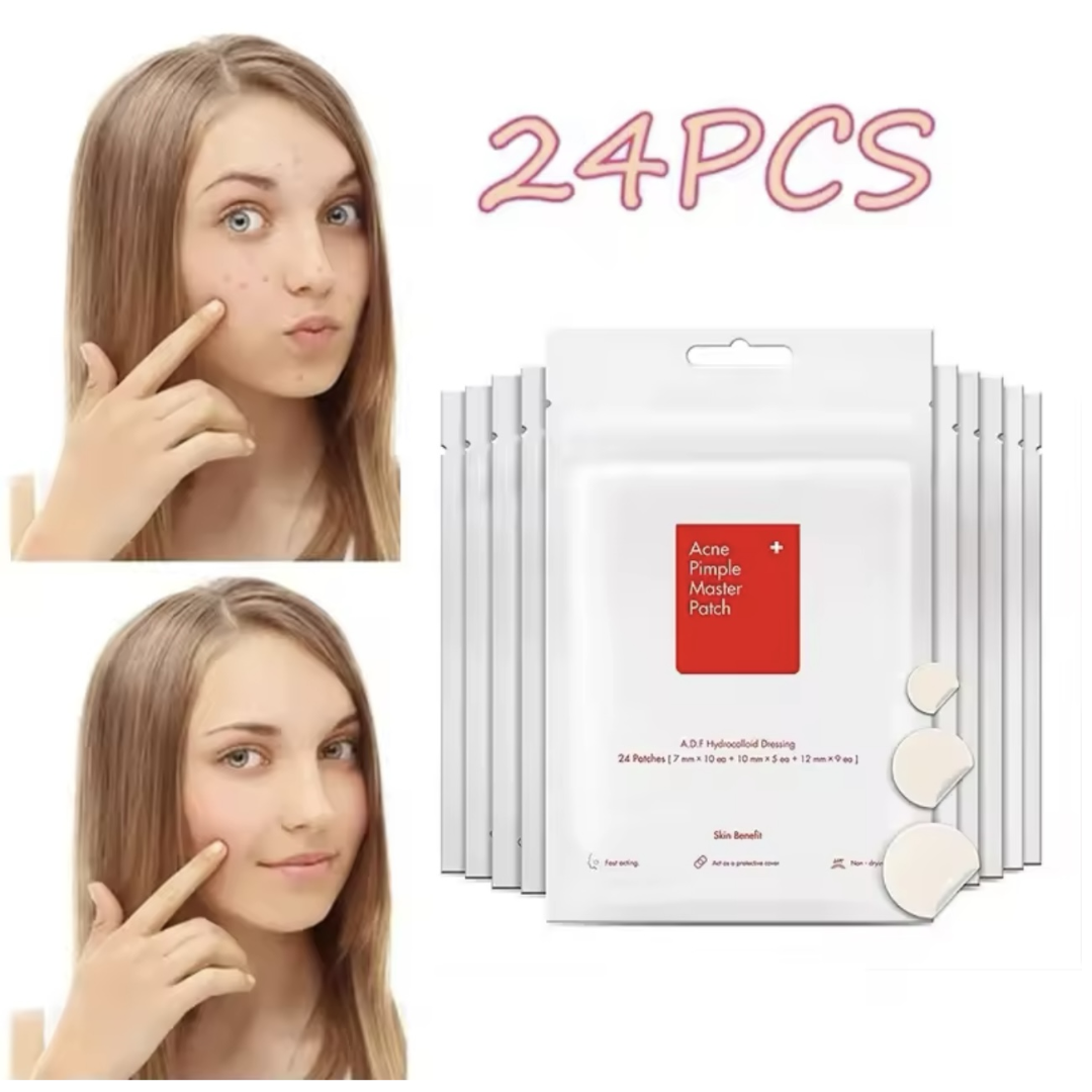 Acne Pimple Spot Facial