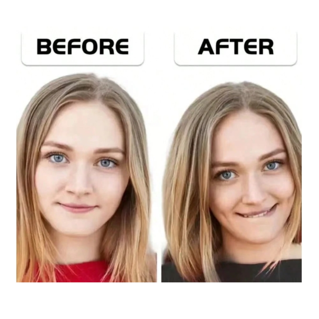 Dimple Makers, Face Dimple