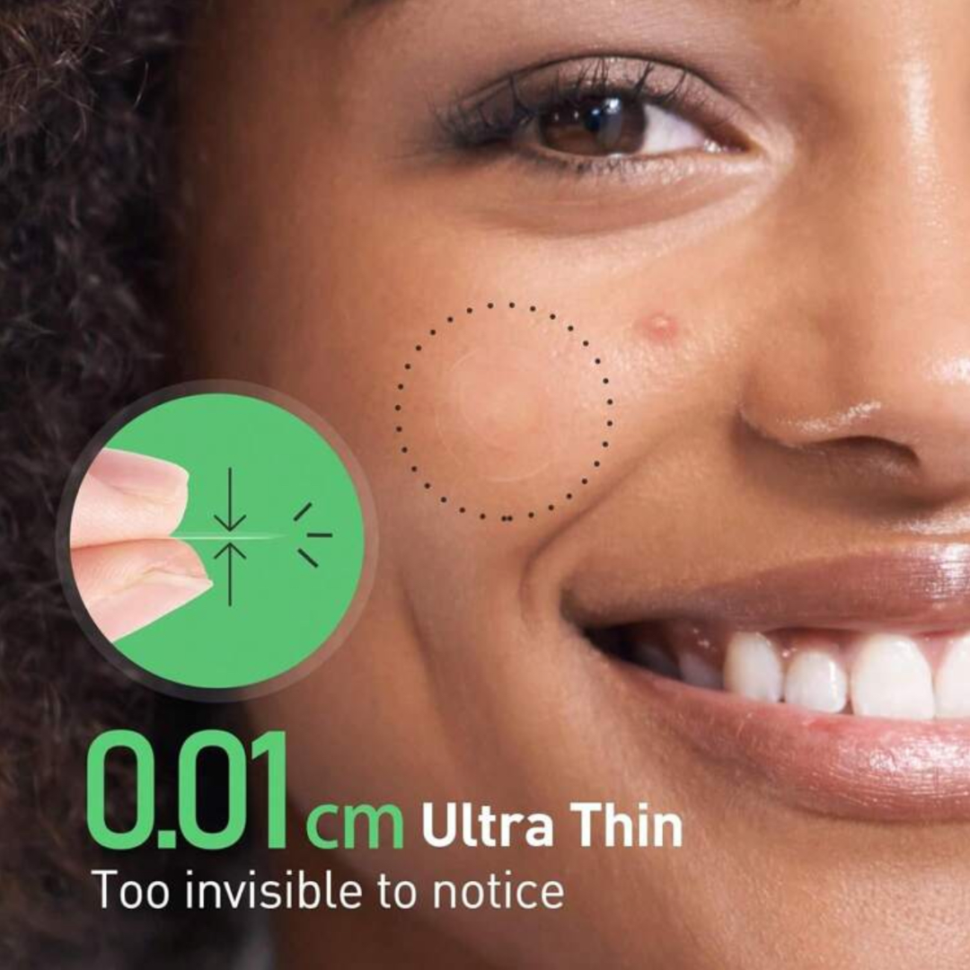 Microneedle Acne Patches