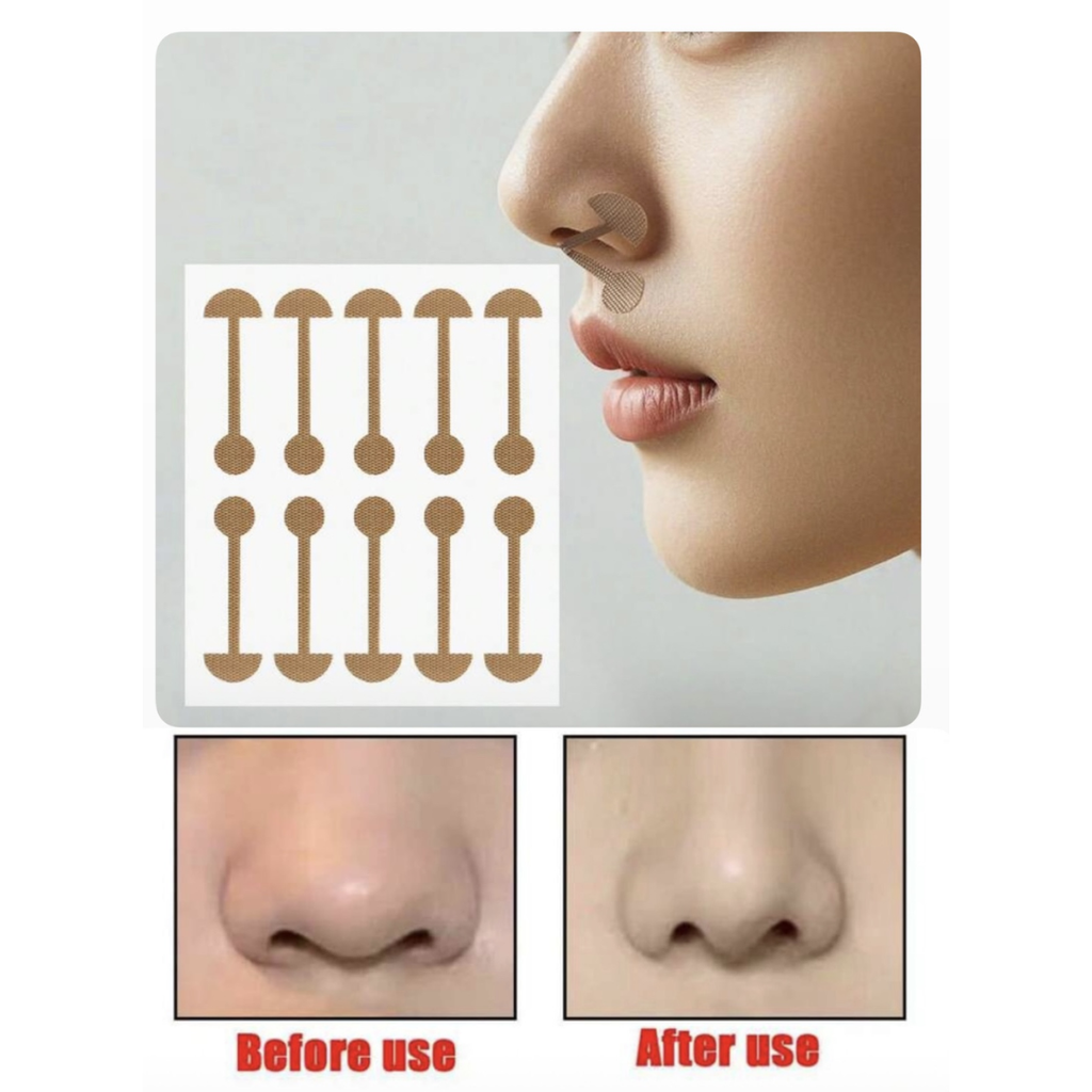 Nose Wing Correction Patches ( 50 pcs)
